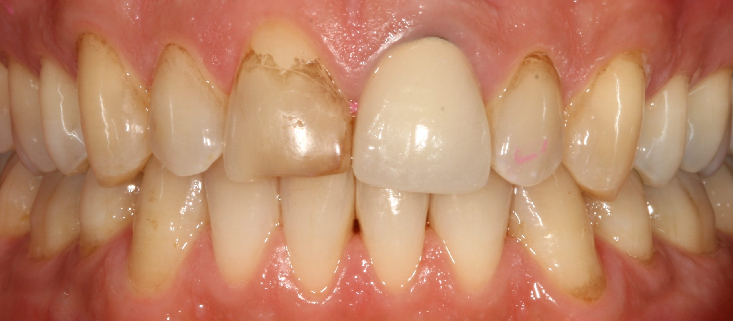 Aesthetic_3_before-scaled