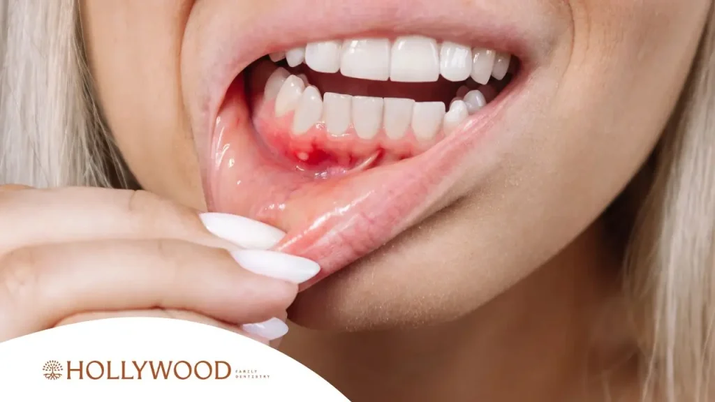 7 Common Signs Your Gums Are Receding