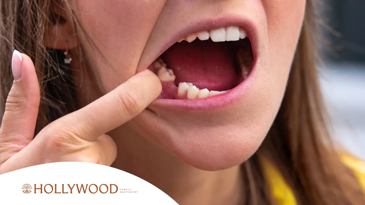 Exploring Your Tooth Replacement Options for Missing Teeth