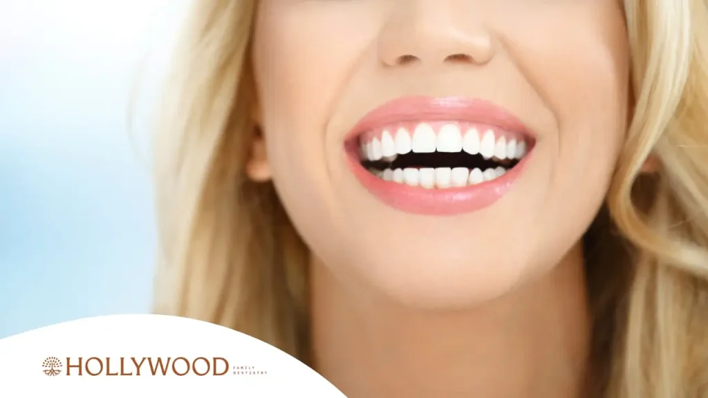 What Is a Smile Makeover and How Long Does It Last?